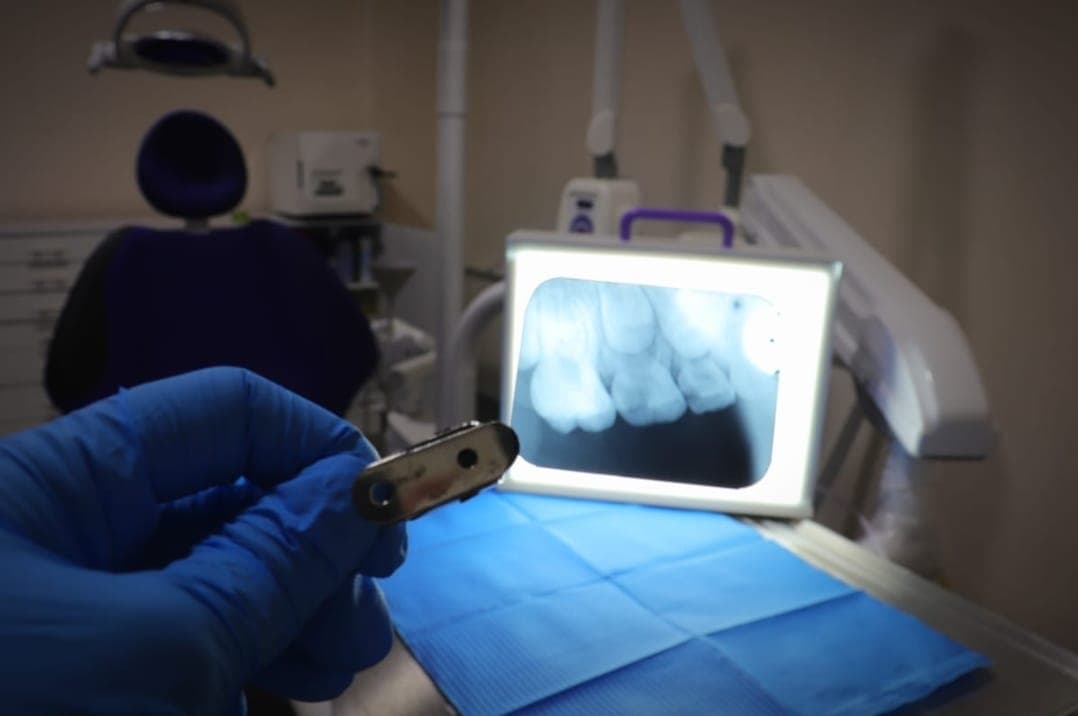 Diagnóstico por radiografía dental